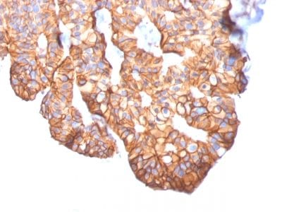 HER-2 / CD340 Monoclonal Mouse Antibody (ERBB2/2452)