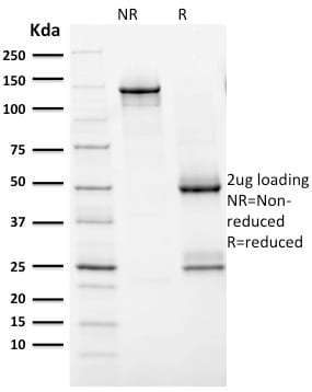 HER-2 / CD340 Monoclonal Mouse Antibody (ERBB2/2452)