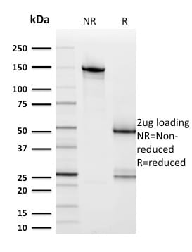 HER-2 / CD340 Monoclonal Mouse Antibody (ERBB2/2453)