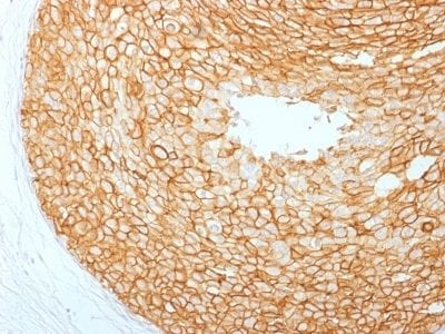 HER-2 / CD340 Monoclonal Mouse Antibody (ERBB2/2453)
