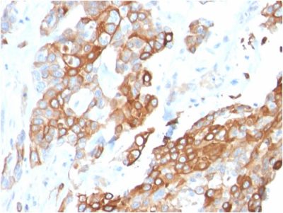 Heregulin-1 / Neuregulin-1 Monoclonal Mouse Antibody (NRG1/2710)