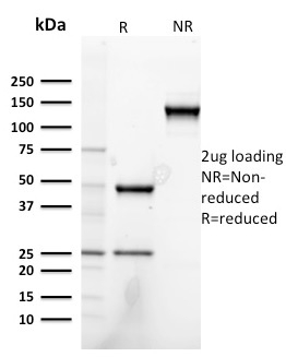 Heregulin-1 / Neuregulin-1 Monoclonal Mouse Antibody (NRG1/2752)
