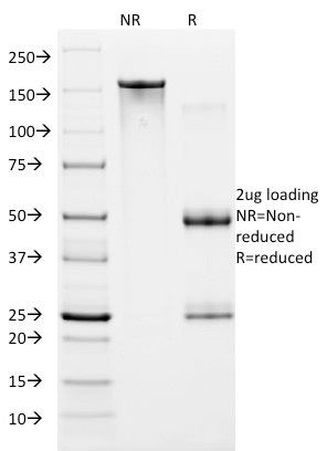 HIF1 Alpha Monoclonal Mouse Antibody (ESEE122)