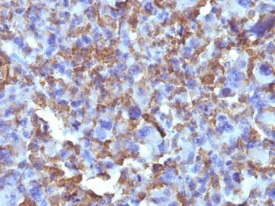 Histiocytoma Marker Monoclonal Mouse Antibody (D11)