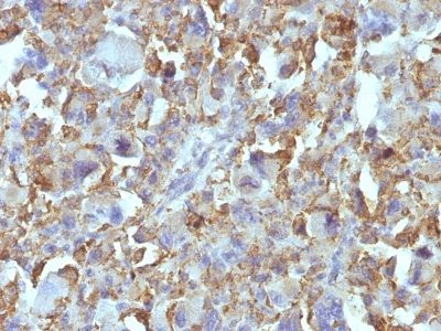 Histiocytoma Marker Monoclonal Mouse Antibody (D11)