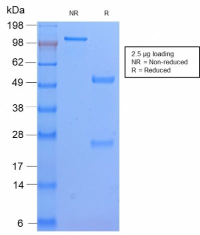 HLA-DP Recombinant Monoclonal Rabbit Antibody (HLA-DPB1/2862R)