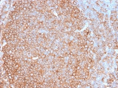 HLA-Pan Recombinant Monoclonal Rabbit Antibody (HLA-Pan/2967R)
