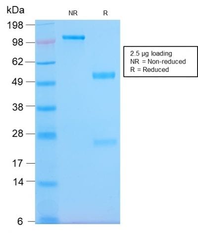 HLA-Pan Recombinant Monoclonal Rabbit Antibody (HLA-Pan/2967R)