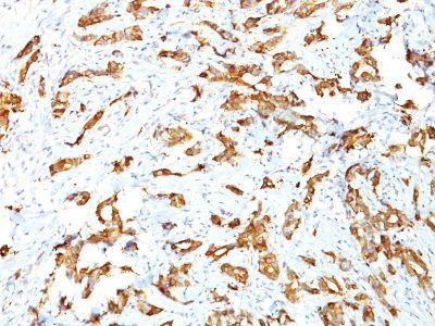 HSP27 Monoclonal Mouse Antibody (G3.1)