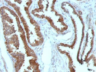 HSP27 Monoclonal Mouse Antibody (HSPB1/774)