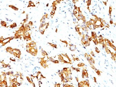 HSP27 Monoclonal Mouse Antibody (HSPB1/774)