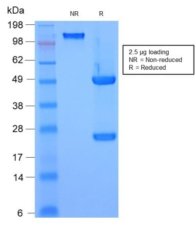 HSP27 Recombinant Monoclonal Mouse Antibody (rHSPB1/774)
