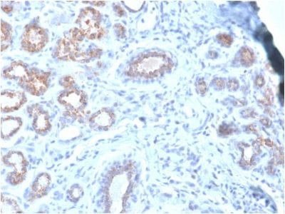 HSP27 Recombinant Monoclonal Mouse Antibody (rHSPB1/774)