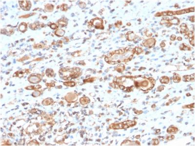 HSP60 Monoclonal Mouse Antibody (CPTC-HSPD1-1)