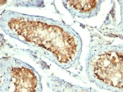 HSP60 Monoclonal Mouse Antibody (GROEL/730)