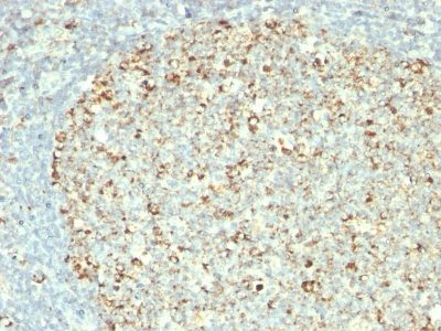 HSP60 Monoclonal Mouse Antibody (GROEL/730)