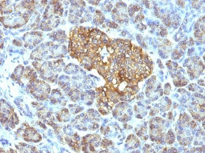 HSP60 Monoclonal Mouse Antibody (GROEL/730)