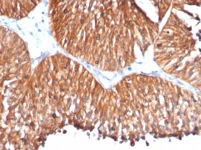 HSP60 Monoclonal Mouse Antibody (HSPD1/780)