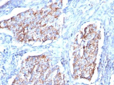 HSP60 Monoclonal Mouse Antibody (HSPD1/780)