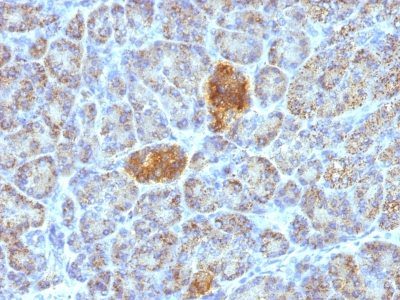 HSP60 Monoclonal Mouse Antibody (HSPD1/780)
