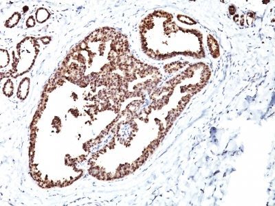 HSP60 Monoclonal Mouse Antibody (LK1)
