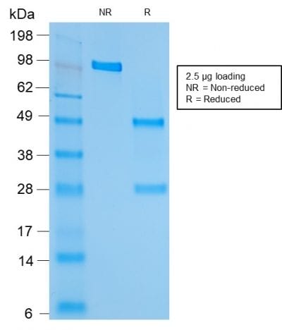 HSP60 Recombinant Monoclonal Mouse Antibody (rGROEL/780)