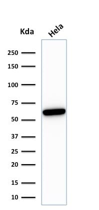 HSP60 Recombinant Monoclonal Mouse Antibody (rGROEL/780)