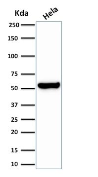 HSP60 Recombinant Monoclonal Rabbit Antibody (HSPD1/2206R)