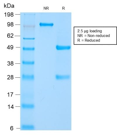 HSP60 Recombinant Monoclonal Rabbit Antibody (HSPD1/2206R)