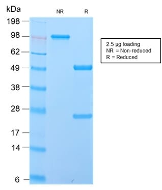Human IgD Recombinant Monoclonal Rabbit Antibody (IGHD/2730R)