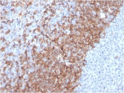 Human IgD Recombinant Monoclonal Rabbit Antibody (IGHD/2730R)