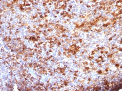 Human IgG Immunoglobulin Monoclonal Mouse Antibody (ICO-97)