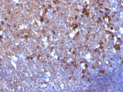 Human IgG Immunoglobulin Monoclonal Mouse Antibody (IG217)