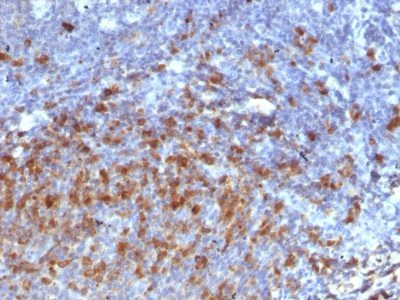 Human IgG Immunoglobulin Monoclonal Mouse Antibody (IG266)