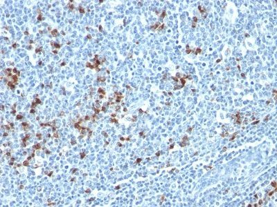 Human Kappa Light Chain Monoclonal Mouse Antibody (HP6053 + L1C1)
