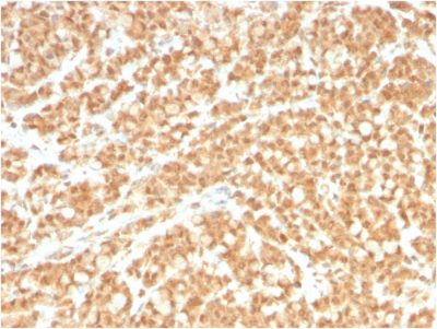 ICOS-L / ICOS Ligand / B7RP-1 Monoclonal Mouse Antibody (ICOSL/3260)