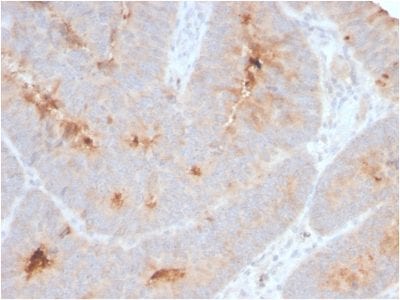 IgA Secretory Component Recombinant Monoclonal Rabbit Antibody (ECM1/2889R)
