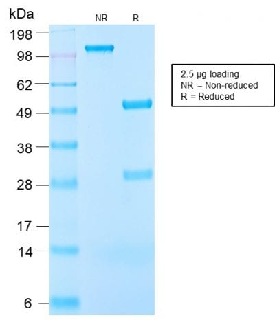 IGF-1 Recombinant Monoclonal Rabbit Antibody (IGF1/2872R)