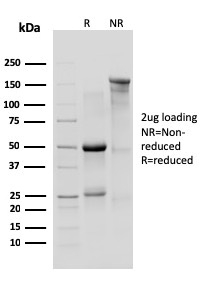 IL-10R1, Mouse Monoclonal Rat Antibody (1B1.3a)