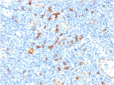 IL3RA / CD123 Monoclonal Mouse Antibody (IL3RA/1531)