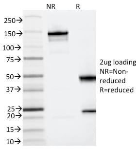 IL3RA / CD123 Monoclonal Mouse Antibody (IL3RA/2065)