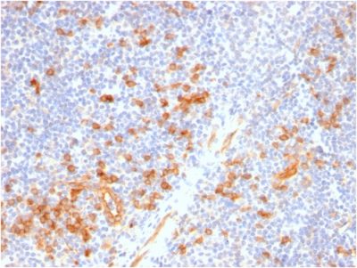 IL3RA / CD123 Recombinant Monoclonal Rabbit Antibody (IL3RA/2947R)