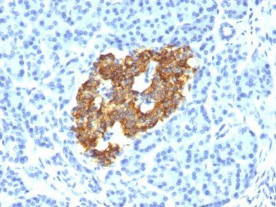 Insulin Monoclonal Mouse Antibody (IRDN/794)