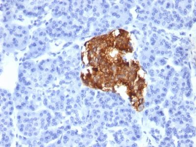 Insulin Monoclonal Mouse Antibody (IRDN/805)