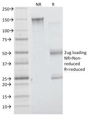 Insulin Receptor Alpha Monoclonal Mouse Antibody (INSR/1661)