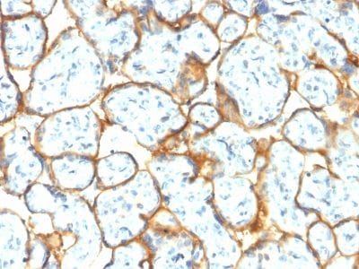 Insulin Receptor Alpha Recombinant Monoclonal Rabbit Antibody (INSR/2277R)