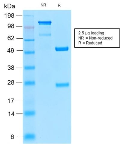 Insulin Receptor Alpha Recombinant Monoclonal Rabbit Antibody (INSR/2277R)