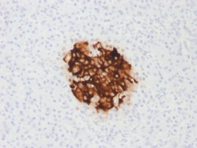 Insulin Recombinant Monoclonal Mouse Antibody (rIRDN/805)