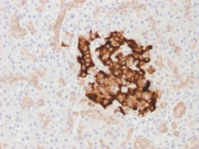 Insulin Recombinant Monoclonal Rabbit Antibody (IRDN/1980R)