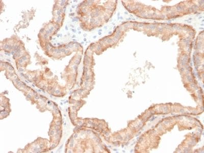 Interleukin 10 Recombinant Monoclonal Rabbit Antibody (IL10/2651R)